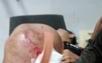 Lakalantas Jalan Lintas Bengkulu-Manna 3 Orang Mengalami Luka Berat