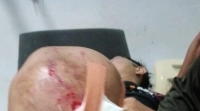 Lakalantas Jalan Lintas Bengkulu-Manna 3 Orang Mengalami Luka Berat